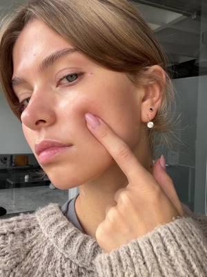 Ad | Got rid of all my dark spots with this glow duo from  @