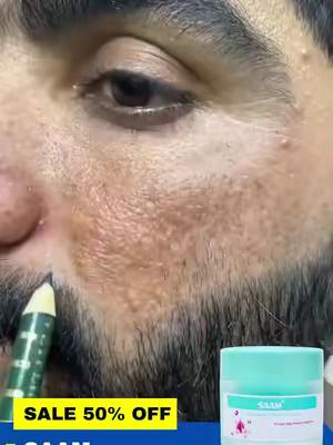 Saam Renewal Face cream for you improve your conditions